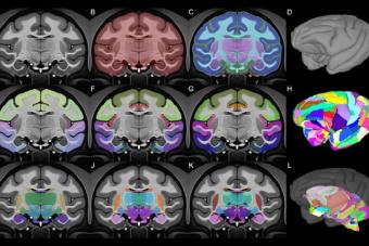 Neuro Image