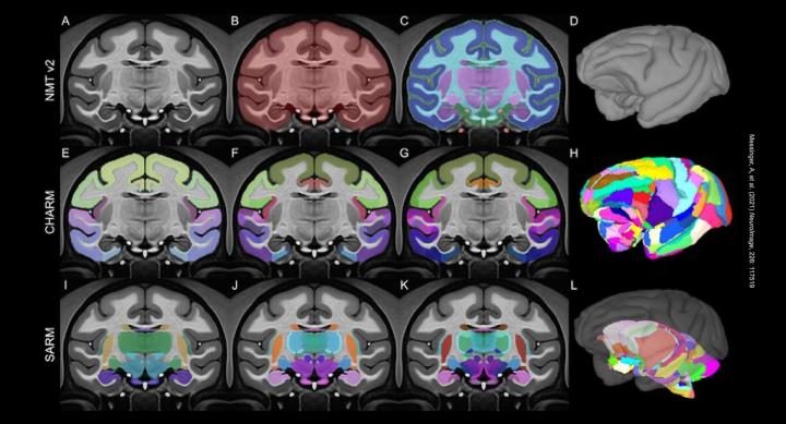 Neuro Image